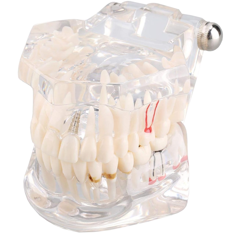 Anatomisk Tandmodell - Tandprotes - White