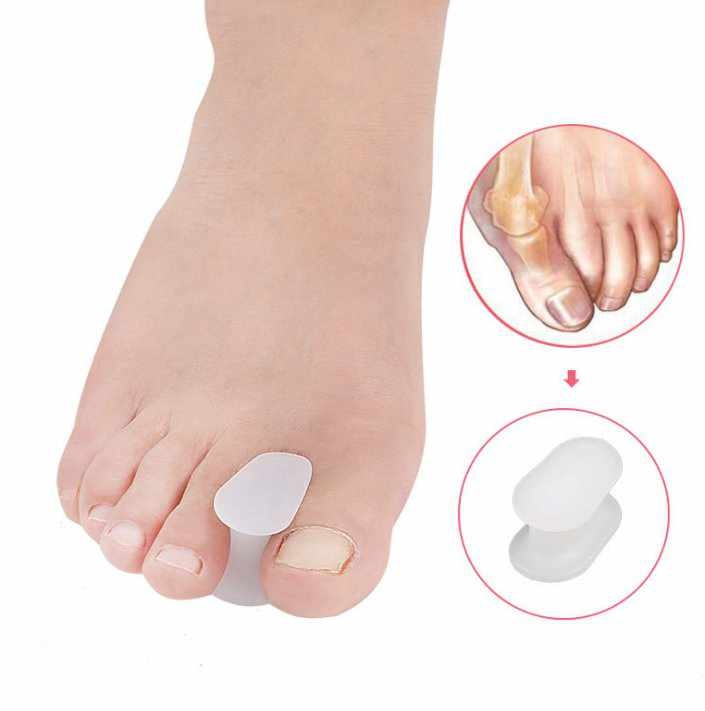 2-Pack - Hallux Valgus Stortåskiljare